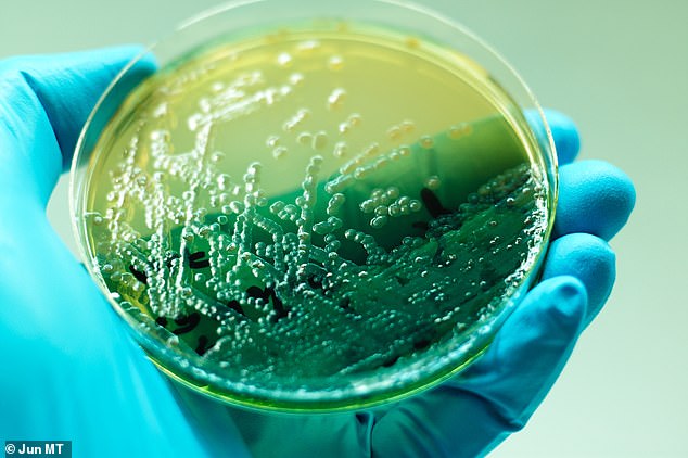 يوصف Pseudomonas aeruginosa بأنه مُمْرِض انتهازي يوجد غالبًا في التربة والمياه الجوفية.  في الصورة ، مستعمرات Pseudomonas aeruginosa على صفيحة أجار