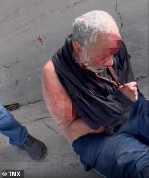 وأظهرت لقطات مزعجة باتريك ملقى على زاوية الطريق السريع بملابس ممزقة بينما كان الدم ينزف من رأسه