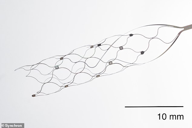 يتم إدخال شريحة الدماغ، التي تسمى Stentrode، في القشرة الحركية حيث يمكنها فك رموز الموجات الدماغية المرتبطة ببعض الوظائف المعرفية.